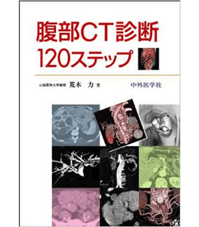 腹部CT診断120ステップ