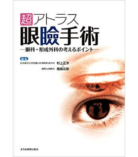 超アトラス眼瞼手術―眼科・形成外科の考えるポイント―