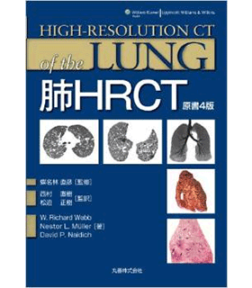 肺HRCT