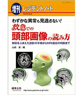 レジデントノート増刊 Vol.16 No.8 わずかな異常も見逃さない! 救急での頭部画像の読み方〜解剖をふまえた読影の手順からMRI適応の判断まで
