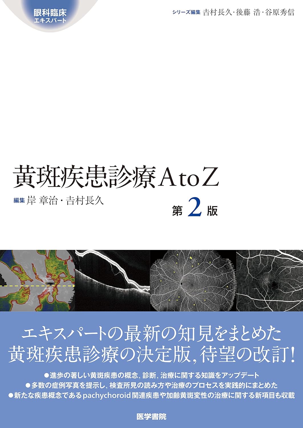黄斑疾患診療AtoZ 第2版 (眼科臨床エキスパート)