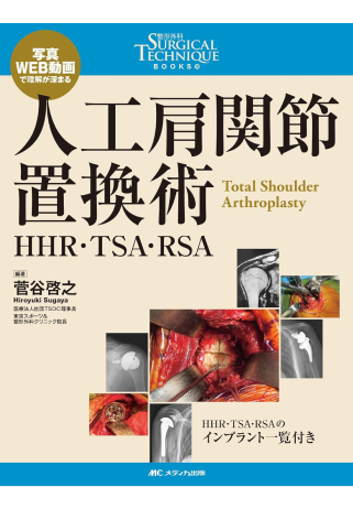 人工肩関節置換術: HHR・TSA・RSA (整形外科SURGICAL TECHNIQUE BOOKS 10)