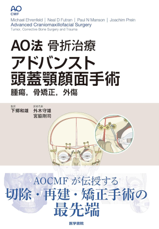 AO法骨折治療 アドバンスト頭蓋顎顔面手術: 腫瘍、骨矯正、外傷