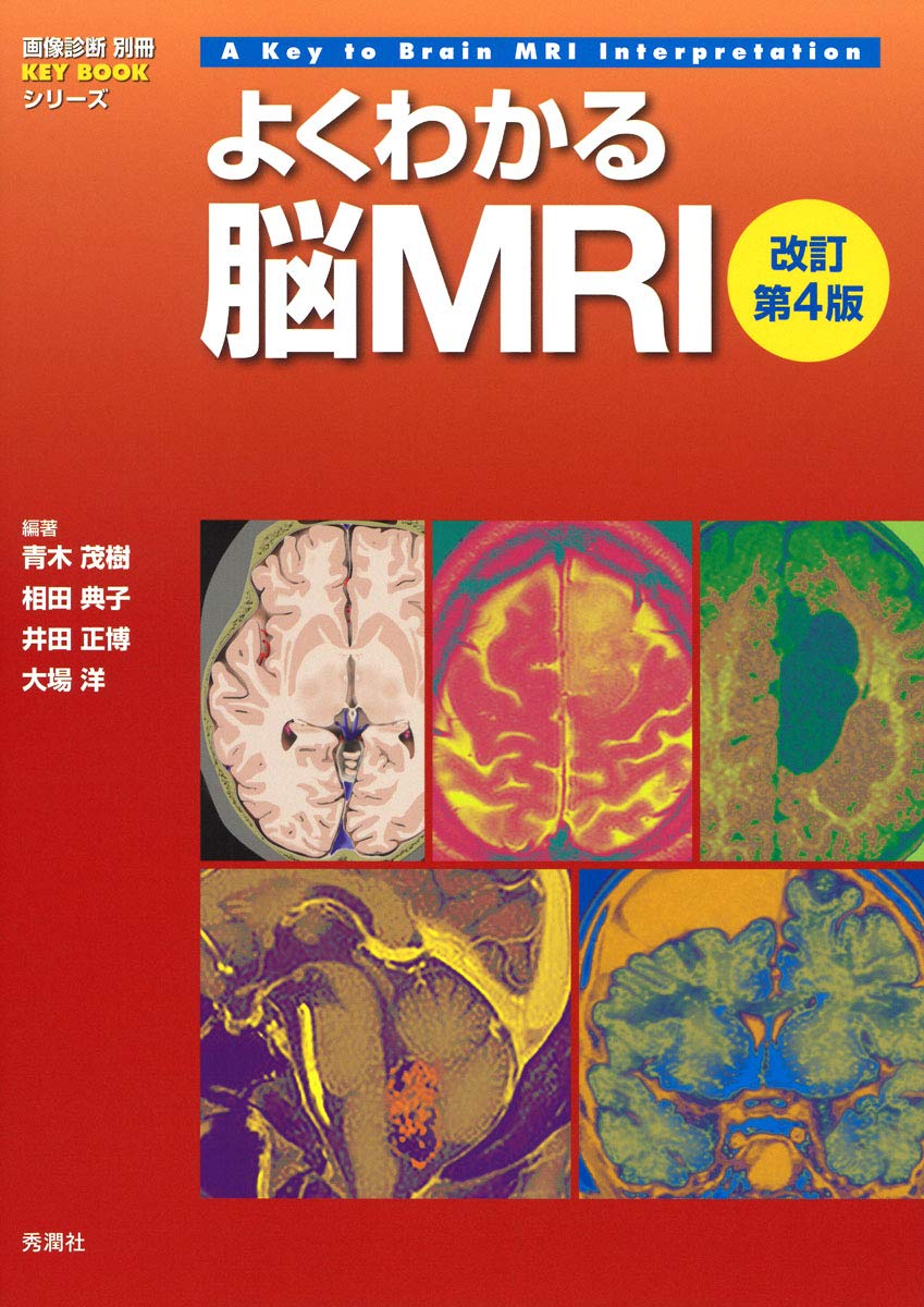 よくわかる脳MRI 改訂第4版 (画像診断別冊KEY BOOKシリーズ)