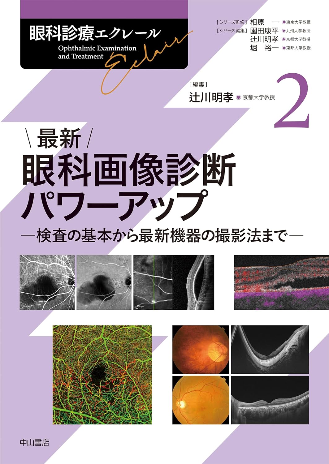 最新 眼科画像診断パワーアップ (眼科診療エクレール 2)